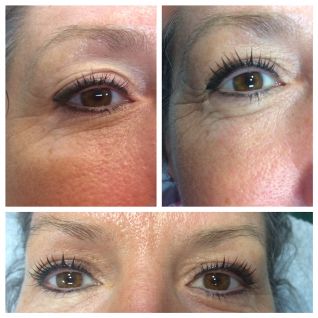 lash-lift-3 lash-lift-3